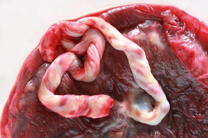 11 things about umbilical cord blood your doctor might not tell you.